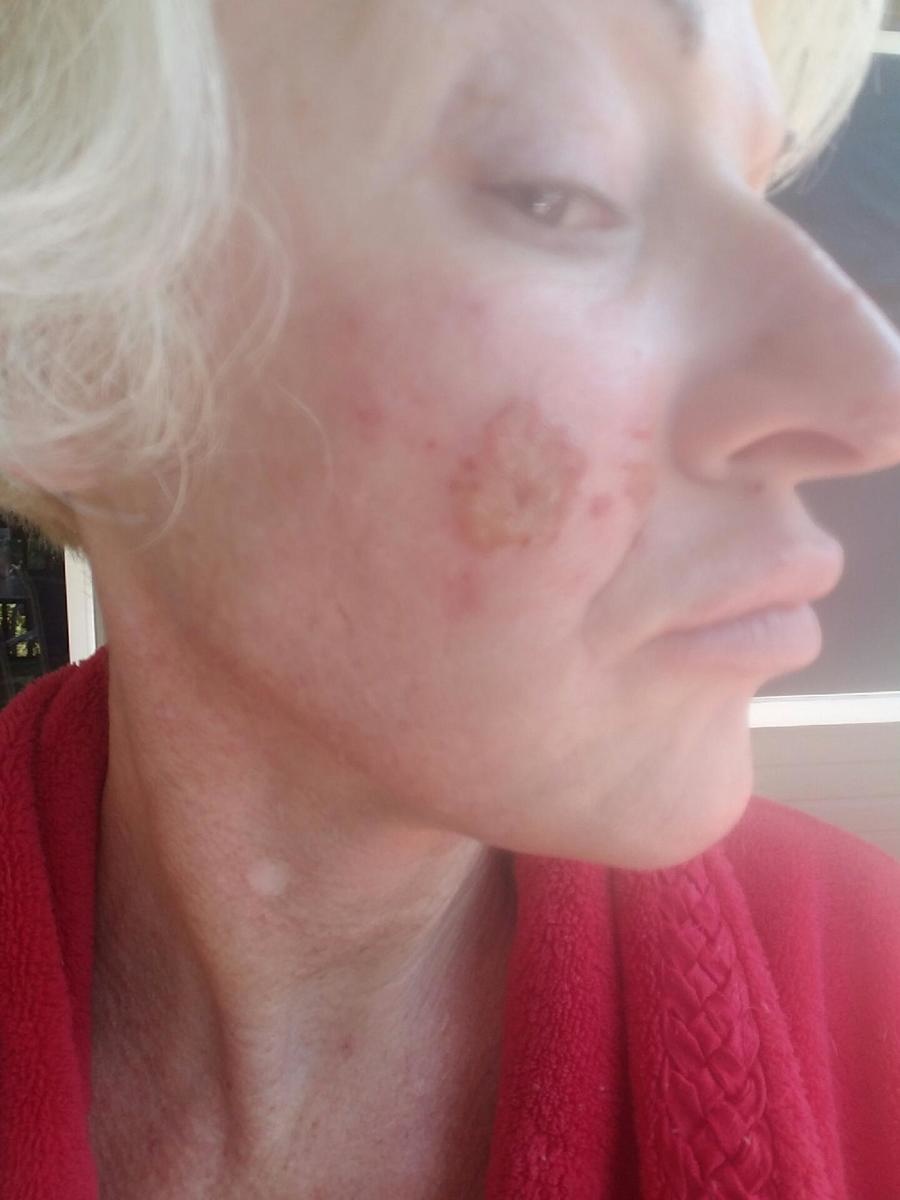 Home Partners Of America F K A Hyperion Homes Not A Good Program